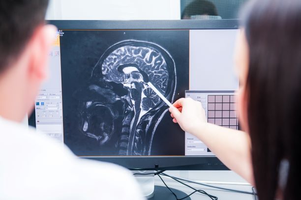doctors looking at image of a brain scan